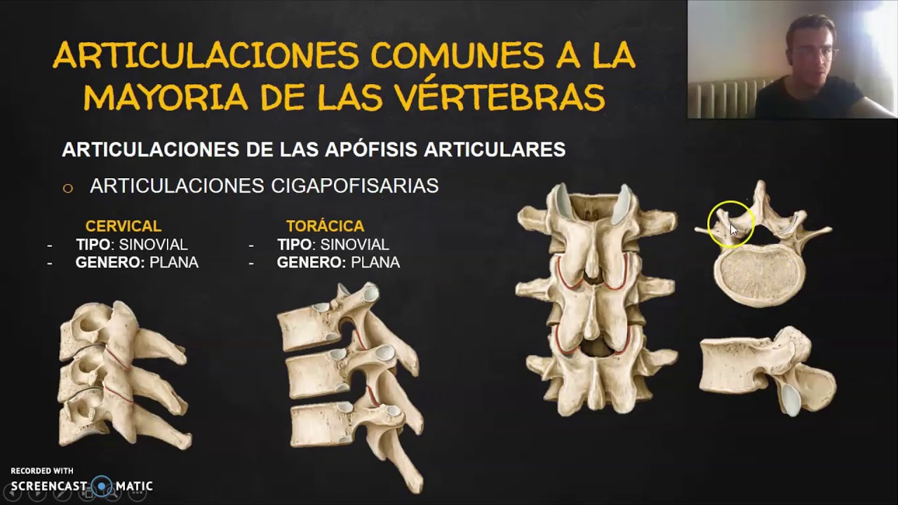 ARTICULACIONES EN COLUMNA VERTEBRAL