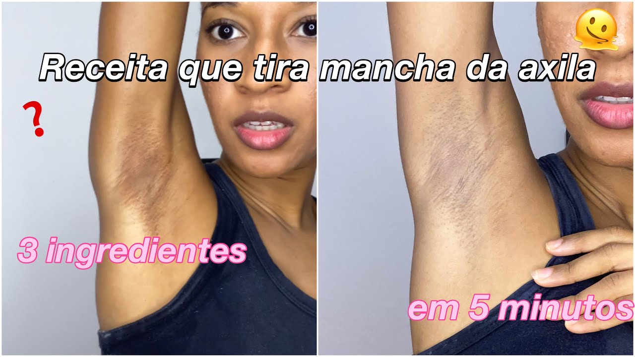 Testei a receita para clarear as axilas ~ tira mancha das axilas em 5 ...