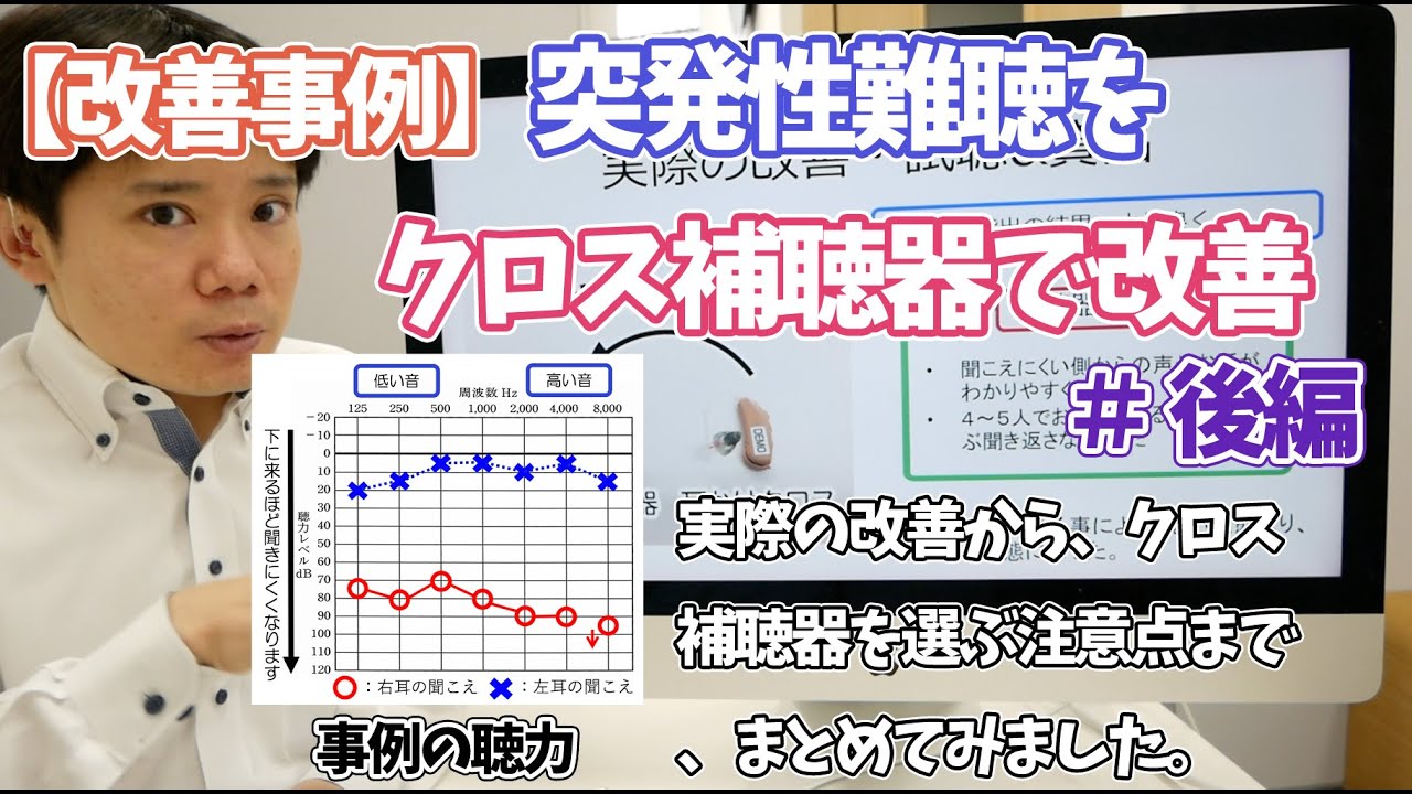 【改善事例】突発性難聴により、片耳が全く聞こえない方をクロス補聴器で改善した事例・後編　実際の聞こえの改善