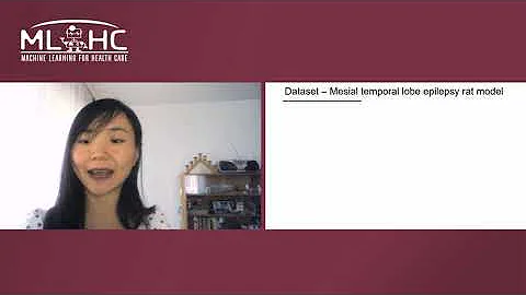 A4 Towards Early Diagnosis of Epilepsy from EEG Data