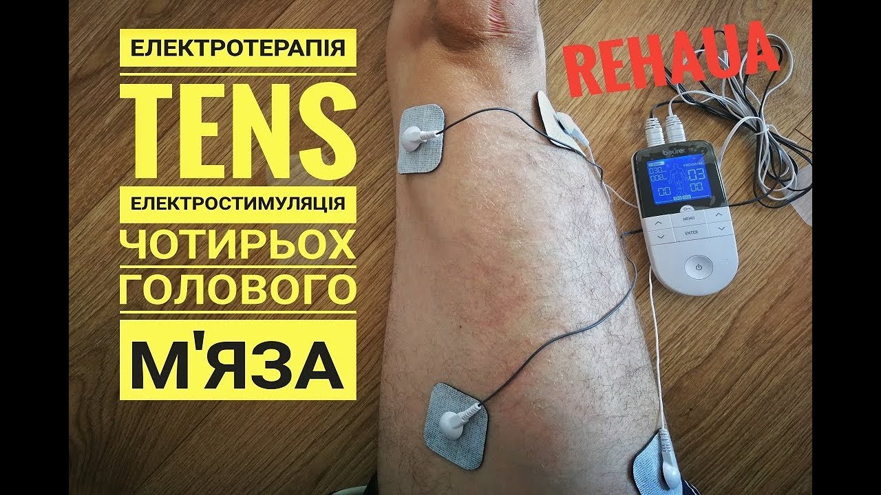 Електротерапія TENS, Електростимуляція чотирьох голового мяза (TENS EMS)