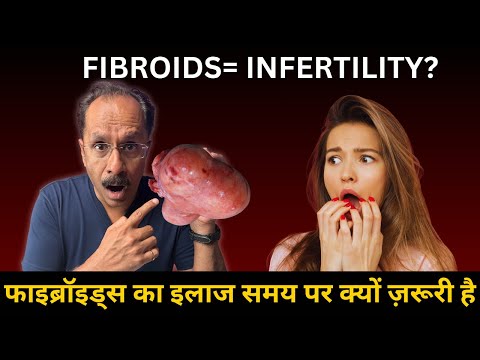 Can You Get Pregnant With Fibroids? | The Ultimate Fertility Guide