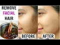 How To Remove Facial Hair (Demonstration) KATORI WAX - In 10 Minutes | Anaysa