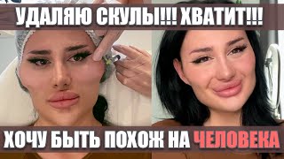 мой первый влог: удаляю скулы, потому что я как тыква