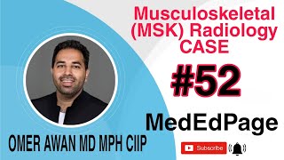 Musculoskeletal (MSK) Radiology CASE #52