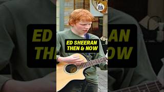 ED SHEERAN'S TRANSFORMATION THEN AND NOW Details