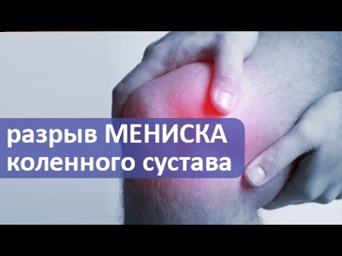 Разрыв мениска коленного сустава лечение в домашних условиях