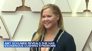 Amy Schumer Reveals She Has Cushing Syndrome