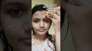 I have oily acne prone skin. &amp; lets see it's suits me or not. #acnefree #acneskincare #dot&amp;key