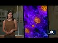 Measles outbreak concerning doctors ahead of school year