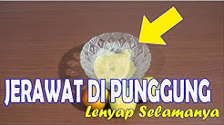 CARA MENGHILANGKAN JERAWAT DI PUNGGUNG DENGAN CEPAT, HANYA MENGGUNAKAN SATU BAHAN || SEHAT TUBE - Durasi: 3.41. CARA MENGHILANGKAN JERAWAT DI PUNGGUNG DENGAN CEPAT, HANYA MENGGUNAKAN SATU BAHAN || SEHAT TUBE - Durasi: 3.41.