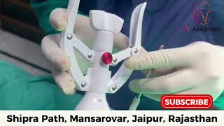 ZSR Circumcision in Jaipur | Painless & Quick Circumcision | Dr. Vikas Gupta