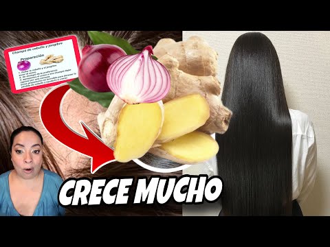 Por qué se te está cayendo el pelo (y cómo arreglarlo)