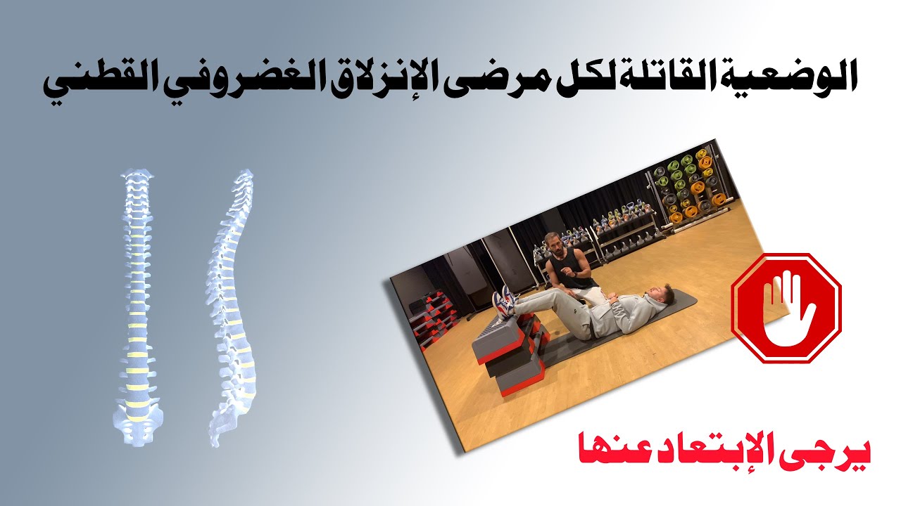 ٧٥- وضعية - الراحة - القاتلة التي ينصح بها كل مرضى الانزلاق الغضروفي.  يرجى الإبتعاد عنها