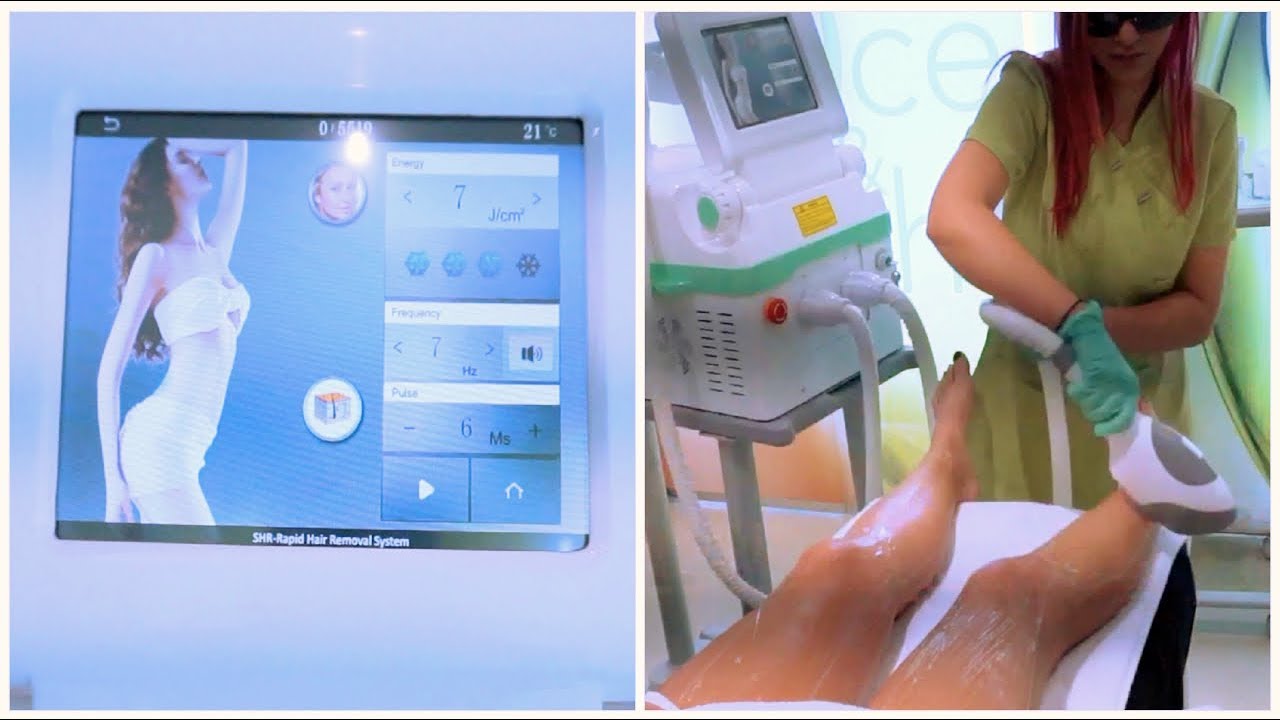 ALLERNIEUWSTE BEHANDELING MET SHR VOOR PERMANENT ONTHAREN VLOG #1