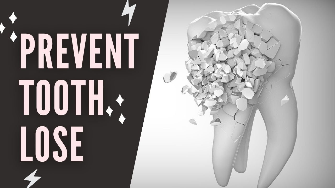 Tooth Loss. How To Prevent Tooth Lose How To Treat Teeth Decay