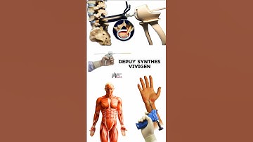 DePuy Synthes - ViviGen #medical #animation #3d #short