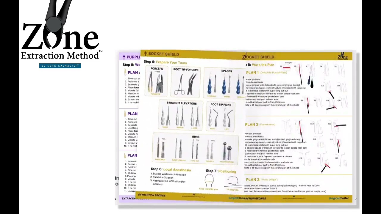 The Zone Extraction Method Recipe Book is out! 🤩Shipping to all dentists registering.