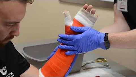 UofU Dept of Orthopaedics: Short-Arm Cast Application