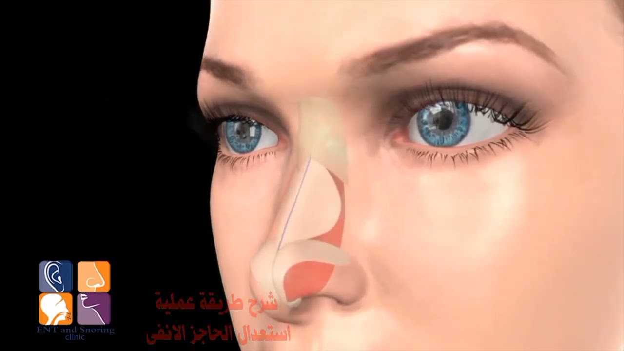 شاهد شرح طريقه عمليه الجيوب الانفيه دكتور محمود يوسف