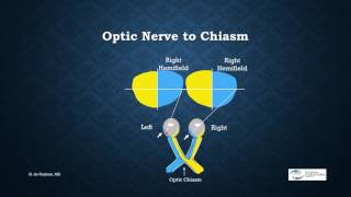 Visual Field - Basics