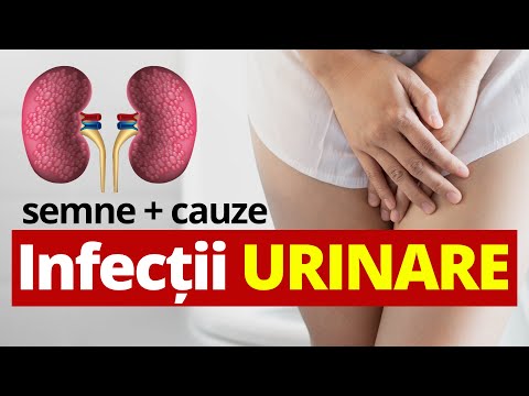 Video: 4 moduri de a utiliza un termometru rectal