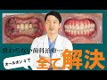 終わらない歯科治療に悩まれる方必見！オールオン4の実例　ナルト先生