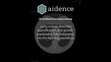 RadNet Radiology AI - RSNA 2022 #shorts