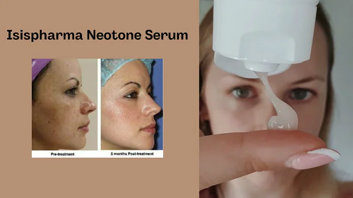 Fjerne pigmentflekker | Pigmentflekker i ansikt | Best i test krem mot pigmentflekker