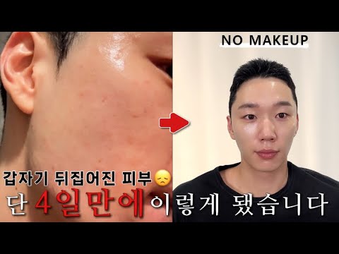 내 피부 광의 비결? 피부 컨디션 이걸로 올리세요