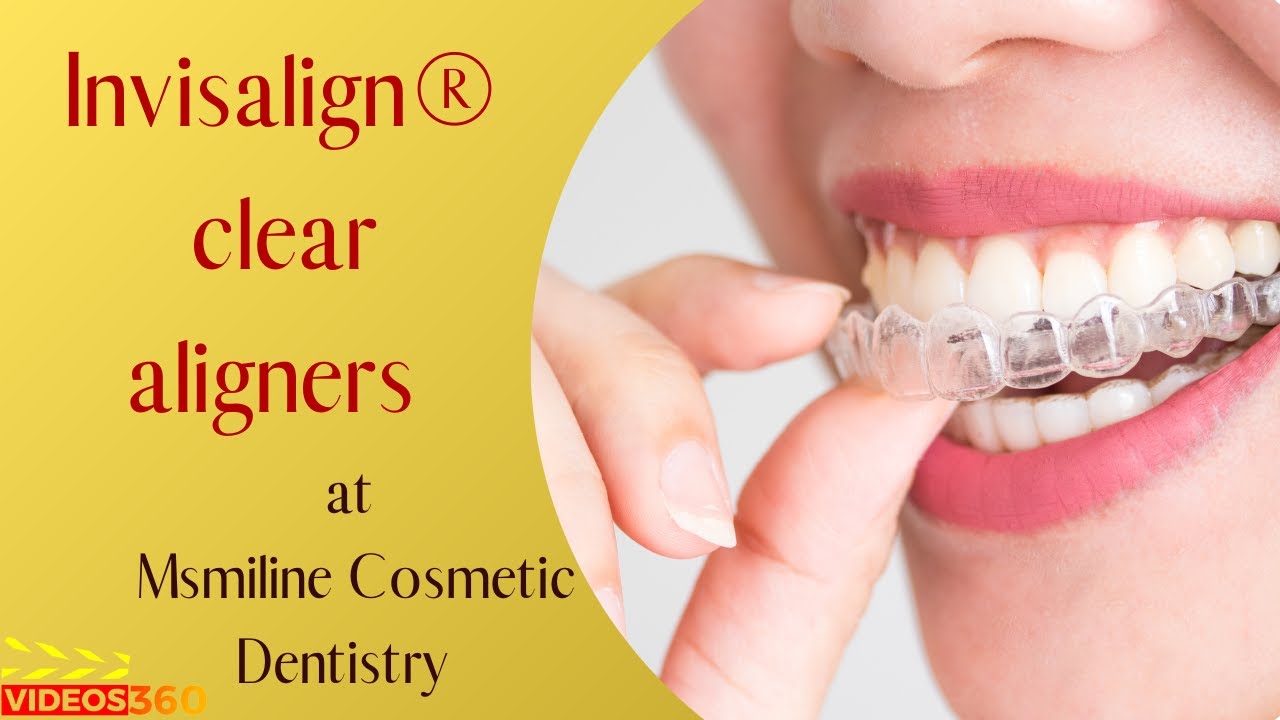 Invisalign Orthodontics Pierrefonds QC - Clear Aligners