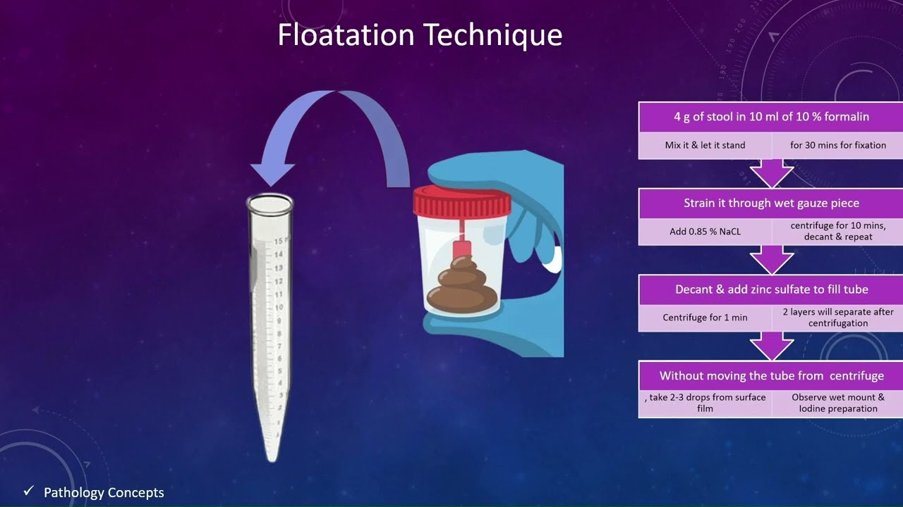 Concentration techniques in Stool | Floatation techniques | Sedimentation techniques | parasites
