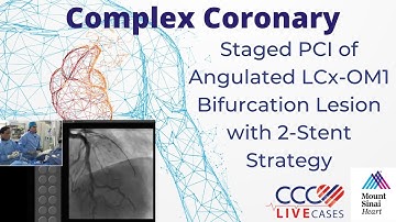 Staged PCI of Angulated LCx-OM1 Bifurcation Lesion with 2-Stent Strategy - CCC Live Feb 2017