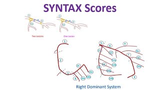 Famous SYNTAX Scores Profile