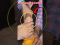 Patellar Dislocation #shorts #youtubeshorts #nursing #nurse #medical #nursingeducation #healthtips