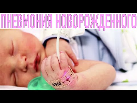 ПНЕВМОНИЯ У НОВОРОЖДЕННОГО РЕБЕНКА | У ребенка пневмония что делать