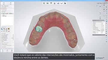 3Shape Clear Aligner Studio - Intersection Visualization and Collision Detection BR PT