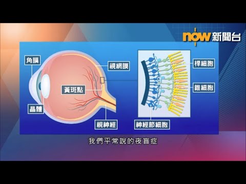 中大眼科 x Now 新聞 : 夜盲症都有先天、後天之分？併發症又會點樣危害視力？