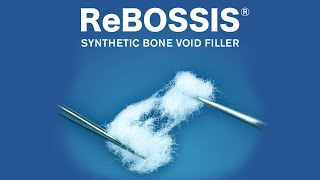 ReBOSSIS HBM