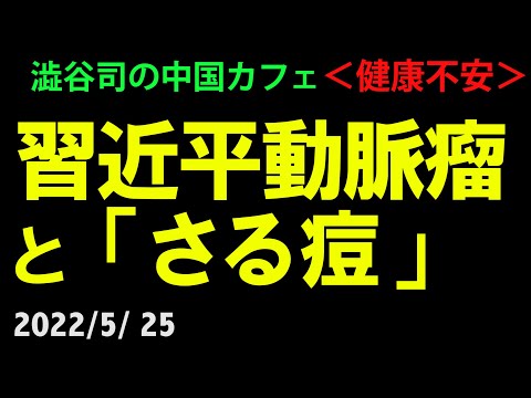 「習近平脳動脈瘤とサル痘」2022/5/25