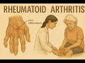 RA  The Treatment Plan