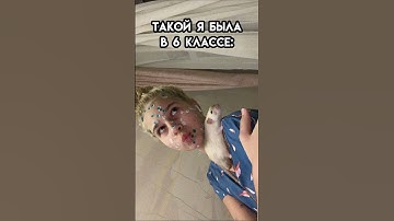 ветрянка..🤯 #shortvideo #video #youtubeshorts