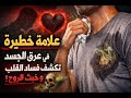 علامة خطيرة تظهر في عرق الجسد تكشف فساد القلب وخبث الروح