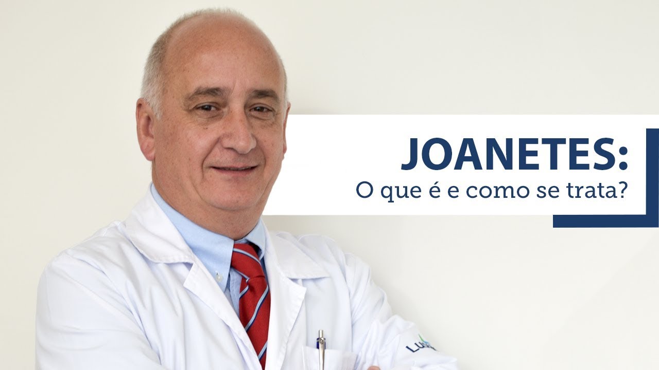 Lusíadas Saúde | Joanetes: qual o tratamento?