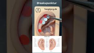 #Øreakupunktur - hofte, knæ, fod, skulder, albue og hånd