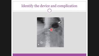 answers of the medical devices quiz