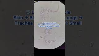 Strongyloides stercoralis (threadworms) is a parasite that can live inside the human