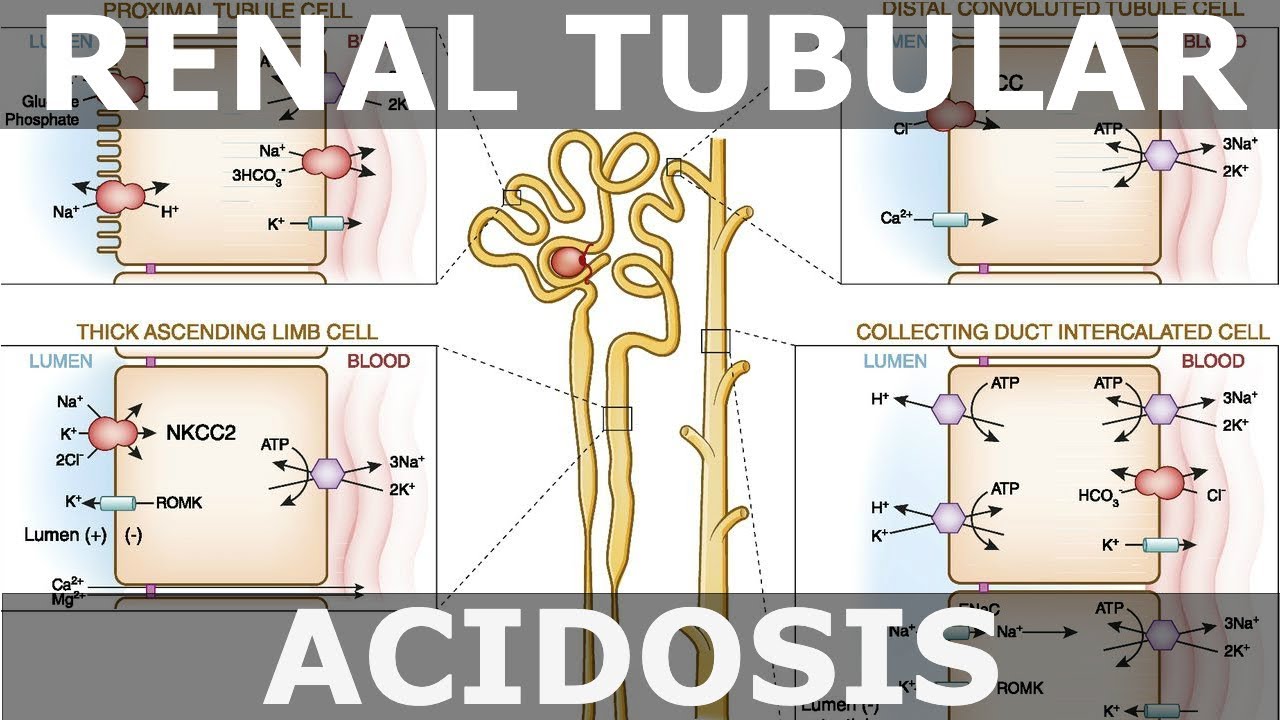 tubular acidosis