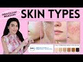 How to Know Your Skin Type | Dermatologist Breaks Down Fitzpatrick Scale & More