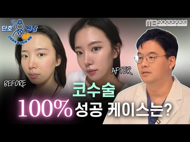 [성형외과 전문의 Q&A] 코수술, 예뻐지는 유형은 따로 있습니다(코성형 자가진단법)